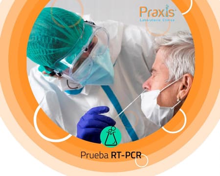 Prueba RT-PCR COVID-19