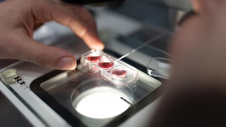 Εικόνα - Το πρόγραμμα δωρεάς ωαρίων μας